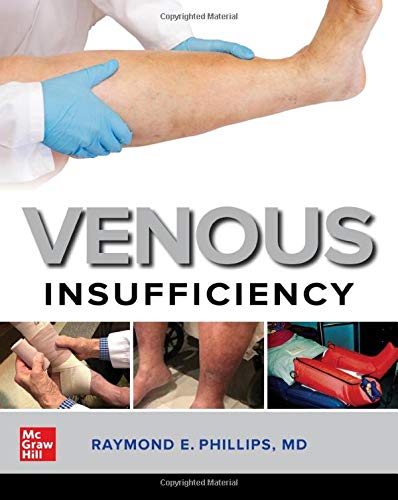 Venous Insufficiency (EPUB)