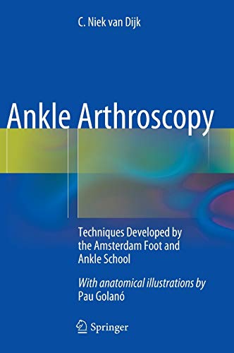 Ankle Arthroscopy: Techniques Developed by the Amsterdam Foot and Ankle School (Original PDF from Publisher)