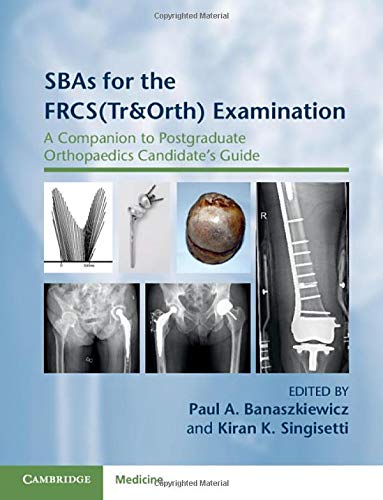 SBAs for the FRCS(Tr&Orth) Examination (A Companion to Postgraduate Orthopaedics Candidate's Guide) (Original PDF from Publisher)