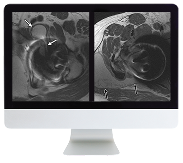 ARRS Controversies in Hip and Pelvis Imaging 2016 (Videos)