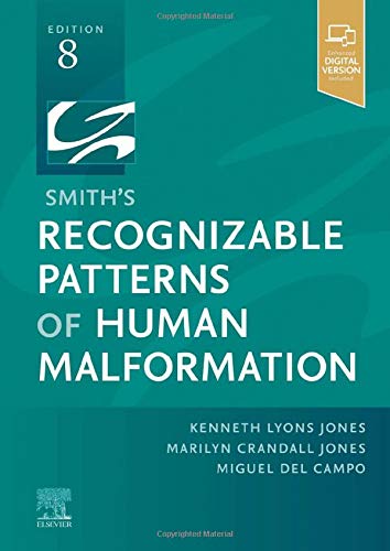 Smith's Recognizable Patterns of Human Malformation, 8th edition (Original PDF from Publisher)