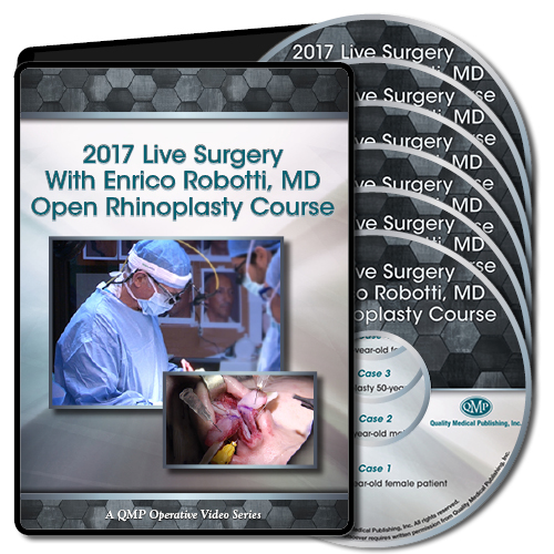 Qmp 2017 Live Surgery With Enrico Robotti Open Rhinoplasty Course (Videos)