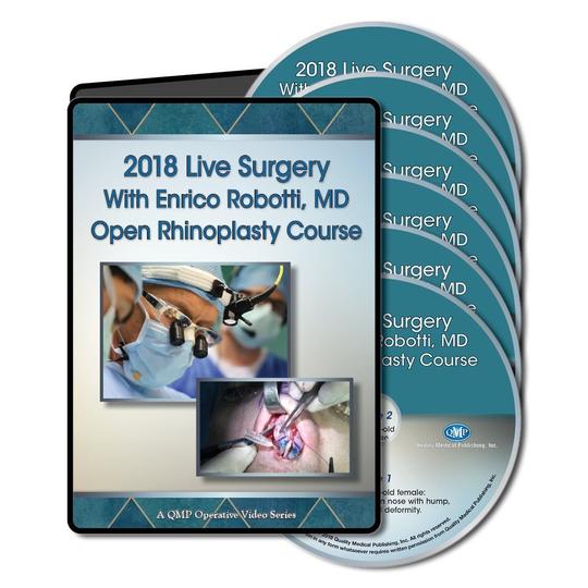 Qmp 2018 Live Surgery With Enrico Robotti Open Rhinoplasty Course (Videos)