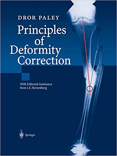 Principles of Deformity Correction (Original PDF from Publisher)