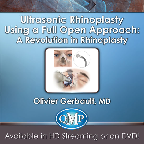 Qmp Ultrasonic Rhinoplasty Using A Full Open Approach: A Revolution In Rhinoplasty 2018 (Videos)