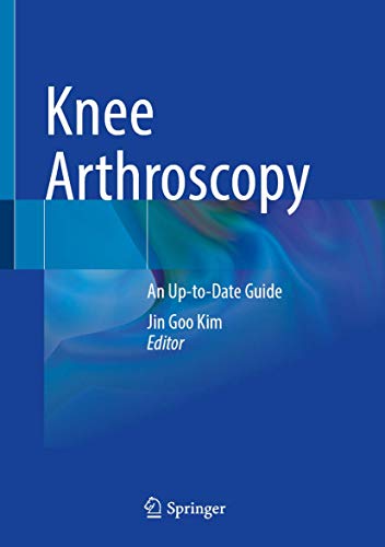 Knee Arthroscopy: An Up-to-Date Guide (Original PDF from Publisher)