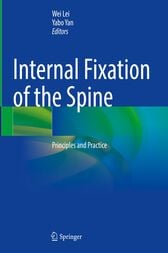 Internal Fixation of the Spine (Original PDF from Publisher)