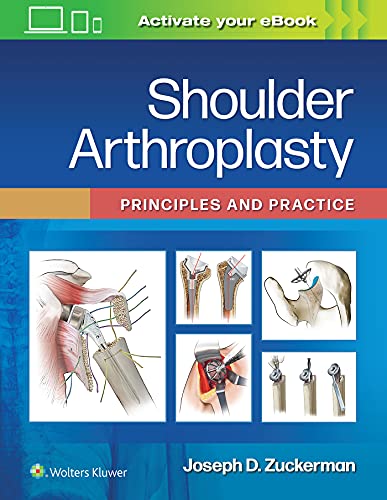 Shoulder Arthroplasty: Principles and Practice (ePub3+Converted PDF ...