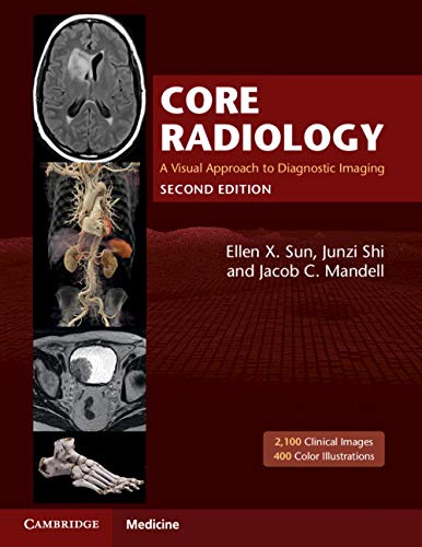 Core Radiology: A Visual Approach to Diagnostic Imaging, 2nd Edition (Original PDF from Publisher)