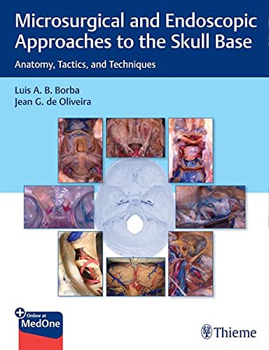 Microsurgical And Endoscopic Approaches To The Skull Base Anatomy Tactics And Techniques 9658
