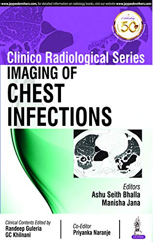 Imaging of Chest Infections (Clinico Radiological) (Original PDF from Publisher)