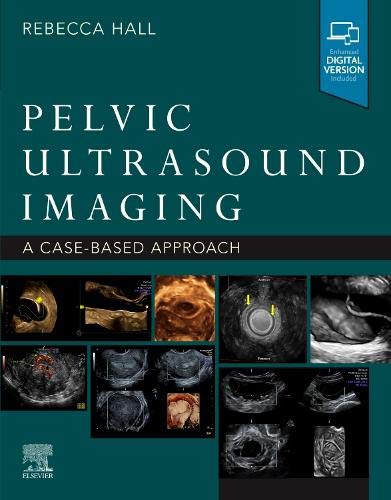 Pelvic Ultrasound Imaging: A Cased-Based Approach (True PDF+ToC+Index)