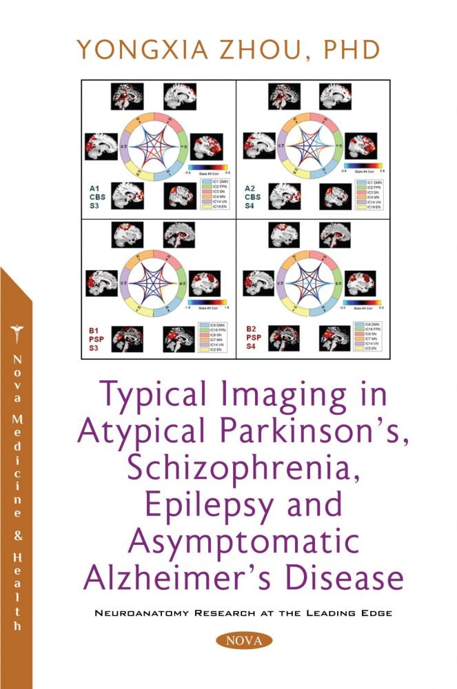 Typical Imaging in Atypical Parkinson’s, Schizophrenia, Epilepsy and Asymptomatic Alzheimer’s Disease (Original PDF From Publisher)