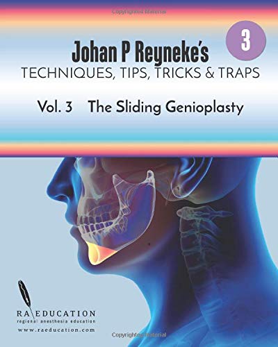 Johan P. Reyneke's Techniques, Tips, Tricks and Traps Vol 3: The Sliding Genioplasty (azw3+ePub+Original PDF)