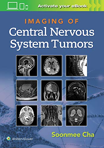 Imaging of Central Nervous System Tumors (ePub3+Converted PDF)