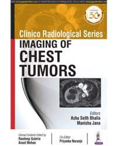 Clinico Radiological Series: Imaging of Chest Tumors (Original PDF from Publisher)