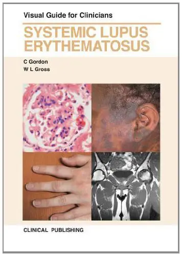 Systemic Lupus Erythematosus: Visual Guide for Clinicians (Original PDF from Publisher)