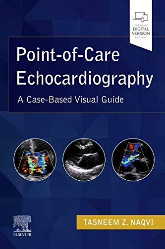 Point Of Care Echocardiography A Clinical Case Based Visual Guide