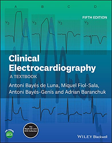 Clinical Electrocardiography: A Textbook, 5th Edition (Original PDF ...