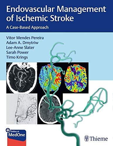 Endovascular Management of Ischemic Stroke: A Case-Based Approach (Original PDF from Publisher)