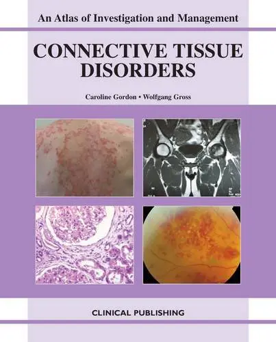 Connective Tissue Disorders: An Atlas of Investigation and Management (Original PDF from Publisher)