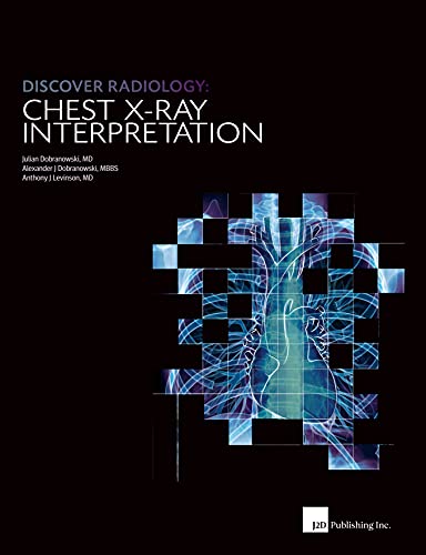 Discover Radiology Chest X-Ray Interpretation : Book for Medical Student (Original PDF from Publisher)