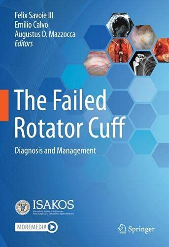 The Failed Rotator Cuff: Diagnosis and Management (Original PDF from Publisher)