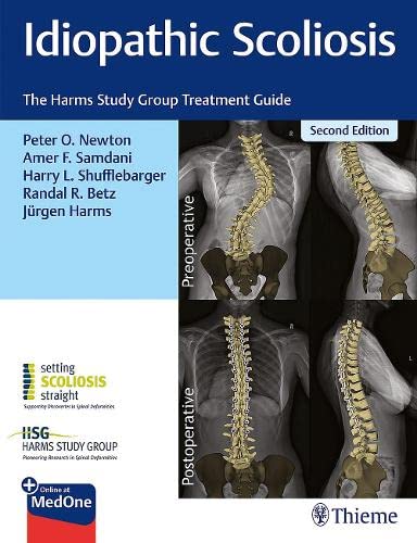 Idiopathic Scoliosis: The Harms Study Group Treatment Guide, 2Nd Edition (Original Pdf From Publisher)