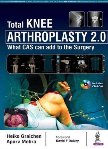 Total Knee Arthroplasty 2.0: What CAS can add to the Surgery (Original PDF from Publisher)