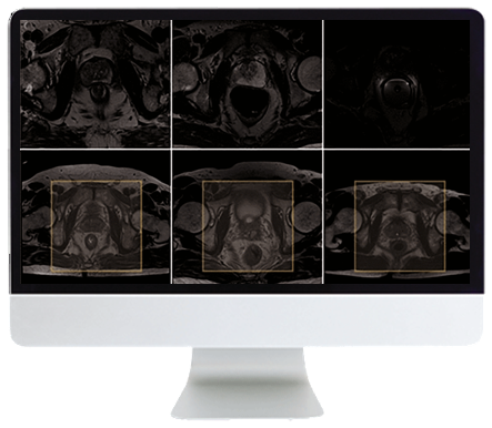 ARRS Pearls and Pitfalls in Prostate and Pelvic Imaging 2021 (Videos)