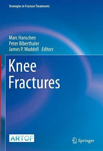 Knee Fractures (Strategies in Fracture Treatments)  (Original PDF from Publisher)