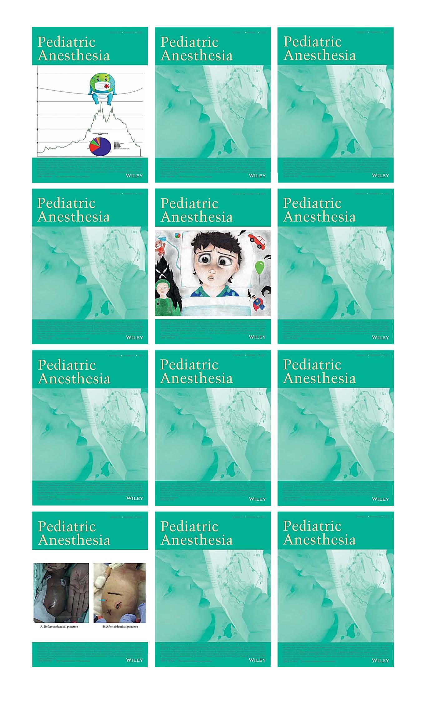 Pediatric Anesthesia 2021 Full Archives (True PDF)