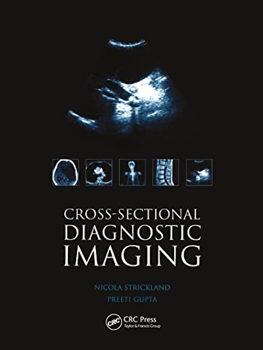Cross-sectional Diagnostic Imaging: Cases for Self Assessment (Original PDF from Publisher)