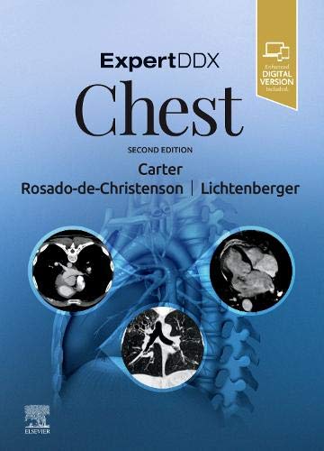 Expertddx: Chest, 2Nd Edition (Original Pdf From Publisher)