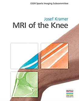 MRI of the Knee, 1st edition (Original PDF from Publisher)