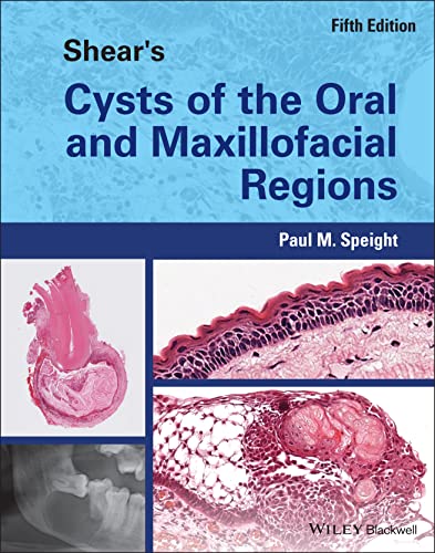 Shear's Cysts of the Oral and Maxillofacial Regions, 5th Edition (Original PDF from Publisher)