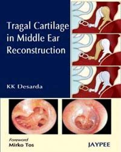 Tragal Cartilage In Middle Ear Reconstruction (Converted Pdf)