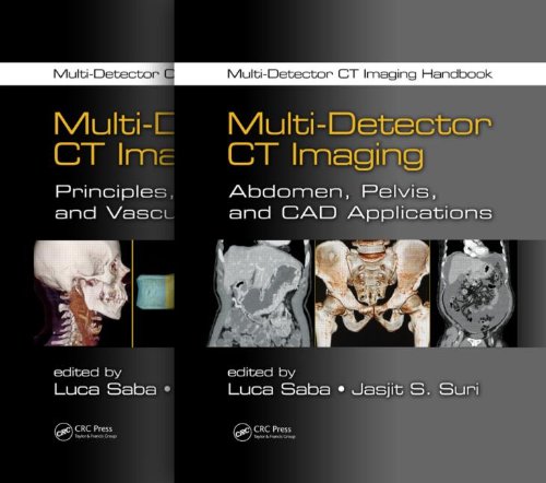 Multi-Detector CT Imaging Handbook, Two Volume Set (Original PDF from Publisher)