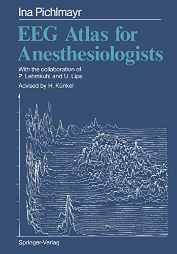 EEG Atlas for Anesthesiologists (Original PDF from Publisher)