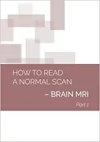 How To Read A Normal Scan: Brain Mri Part 1 (High Quality Image Pdf)