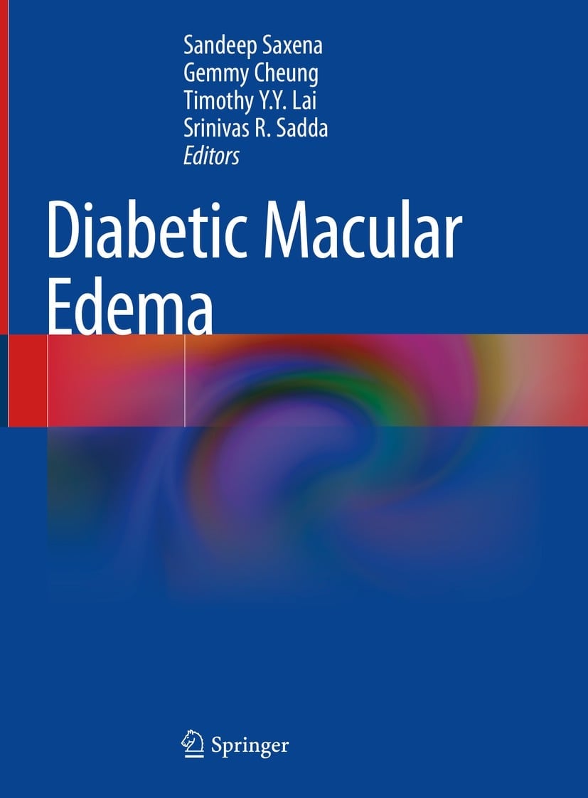 Diabetic Macular Edema (EPUB)