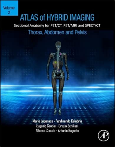 Atlas of Hybrid Imaging Sectional Anatomy for PET/CT, PET/MRI and SPECT/CT Vol. 2: Thorax Abdomen and Pelvis: Sectional Anatomy for PET/CT, PET/MRI and SPECT/CT (Original PDF from Publisher)