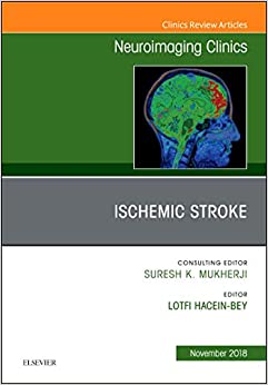 Ischemic Stroke, An Issue of Neuroimaging Clinics of North America (Volume 28-4) (The Clinics: Radiology, Volume 28-4) (Original PDF from Publisher)