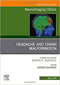 Headache and Chiari Malformation, An Issue of Neuroimaging Clinics of North America (Volume 29-2) (The Clinics: Radiology, Volume 29-2) (Original PDF from Publisher)