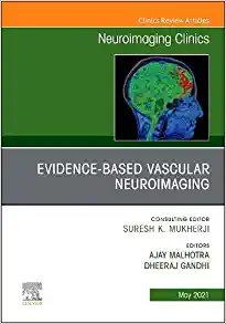 Evidence-Based Vascular Neuroimaging, An Issue of Neuroimaging Clinics of North America (Volume 31-2) (The Clinics: Radiology, Volume 31-2) (Original PDF from Publisher)
