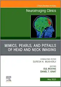 Mimics, Pearls and Pitfalls of Head & Neck Imaging, An Issue of Neuroimaging Clinics of North America (Volume 32-2) (The Clinics: Internal Medicine, Volume 32-2) (Original PDF from Publisher)