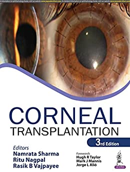 Corneal Transplantation, 3rd edition (Original PDF from Publisher)