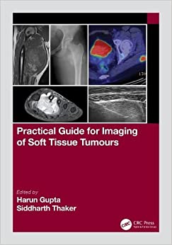 Practical Guide for Imaging of Soft Tissue Tumours (EPUB)