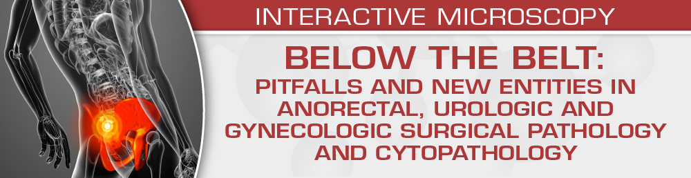 USCAP BELOW THE BELT: Pitfalls and New Entities in Anorectal, Urologic and Gynecologic Surgical Pathology and Cytopathology 2023 (CME VIDEOS)