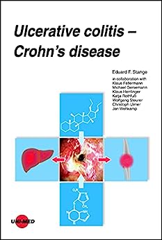 Ulcerative colitis - Crohn’s disease (UNI-MED Science) (Original PDF from Publisher)